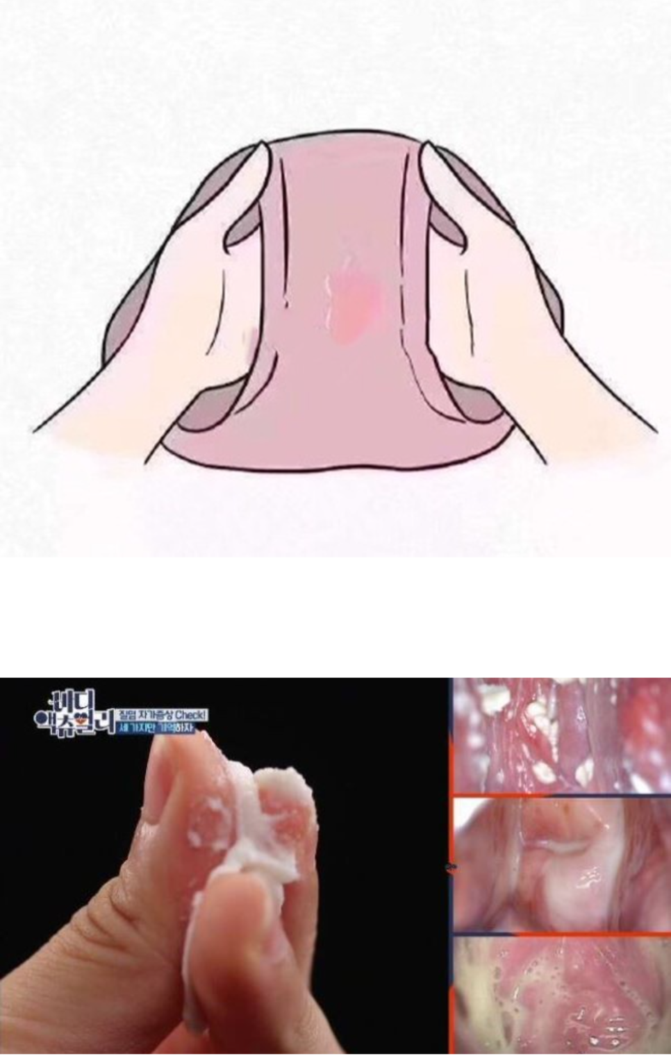 로즈맘산부인과 이미지