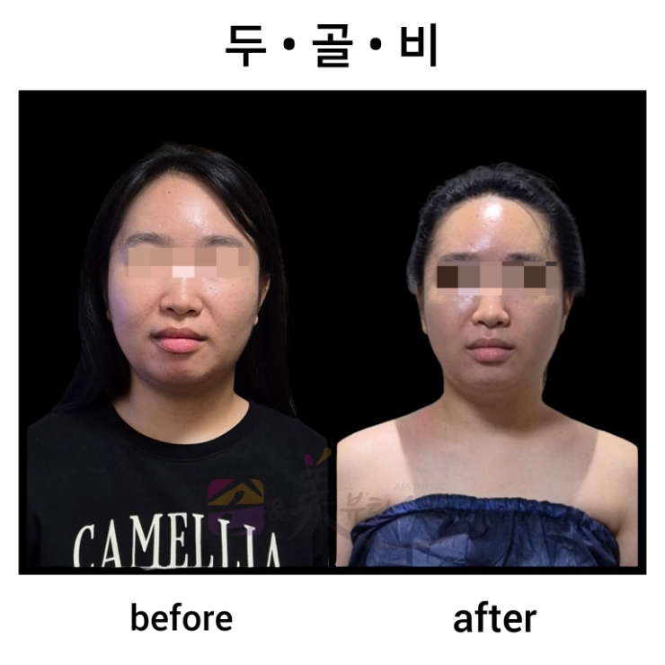 미소앤미 이미지