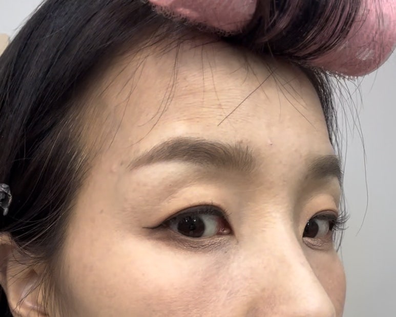 보나럭스 이미지