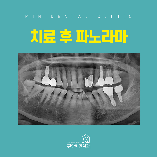 편안한민치과 이미지