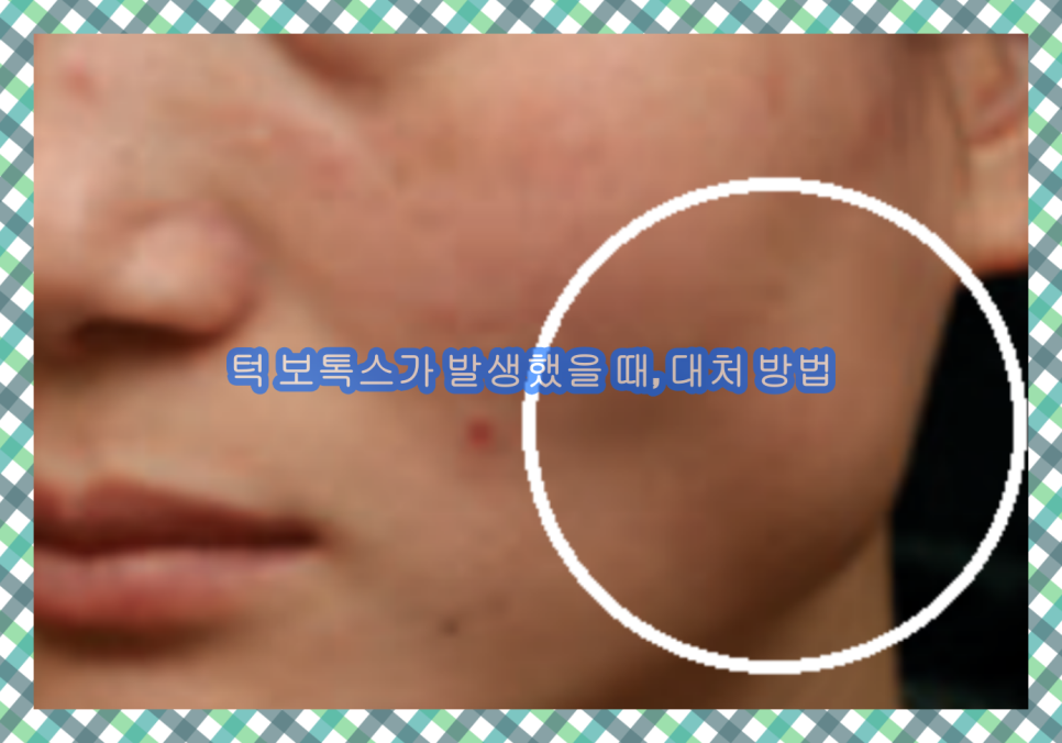 근이케이스 이미지