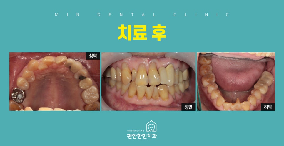 편안한민치과 이미지