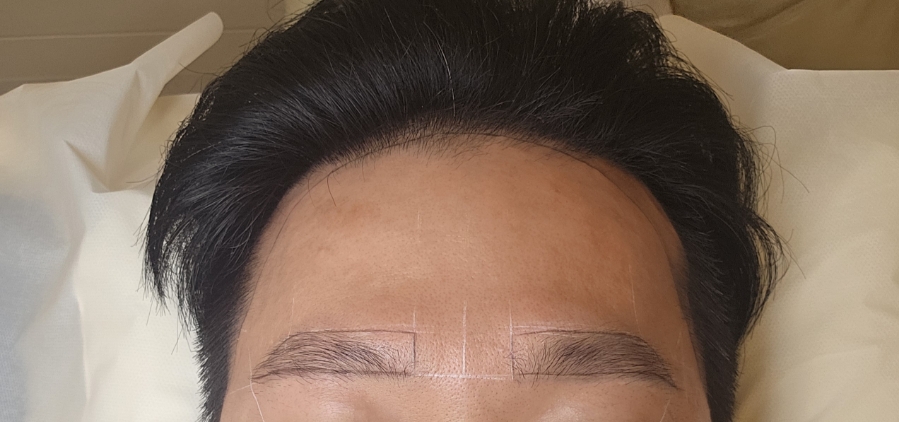 퀸헤어라인 이미지