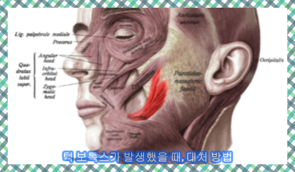 근이케이스 이미지