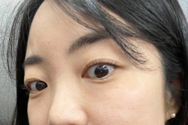 EYE이뻐 이미지