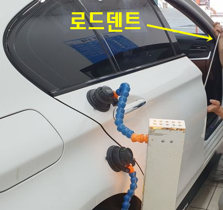 슈퍼덴트칼라 이미지