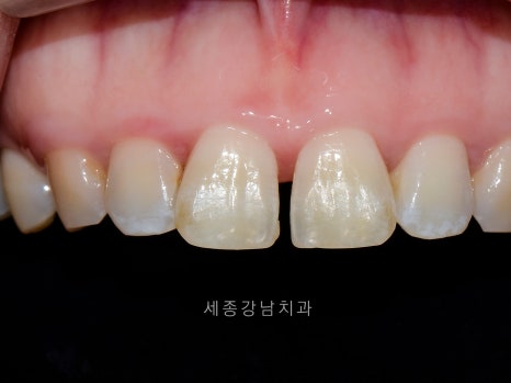 강남세종치과의원 이미지