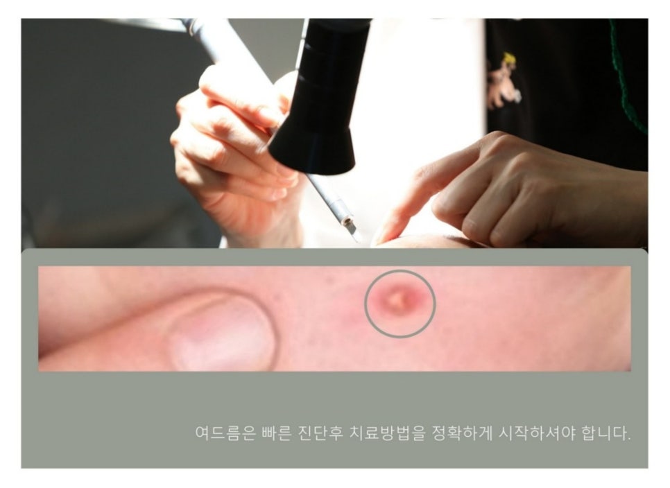예스피부과의원 이미지