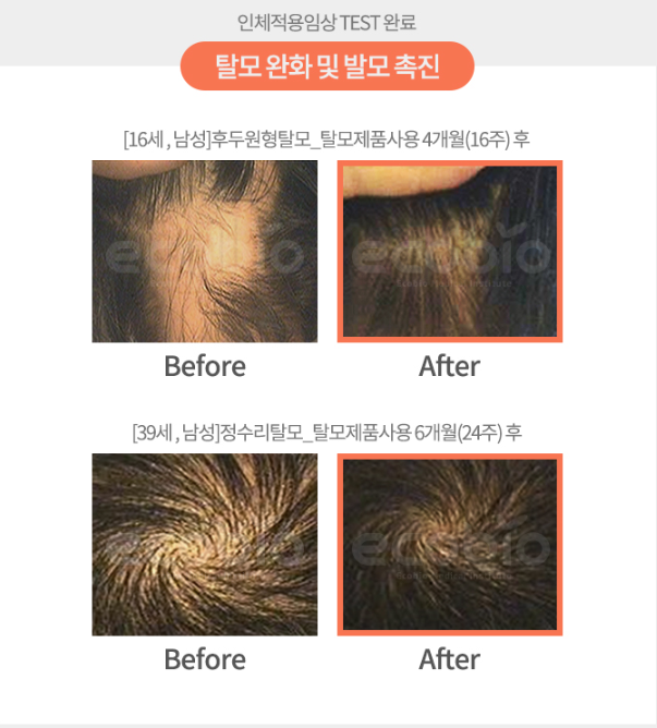 아로마헤어 이미지
