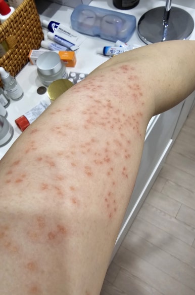 서울피부비뇨기과 이미지