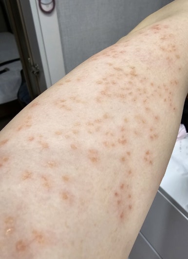 서울피부비뇨기과 이미지