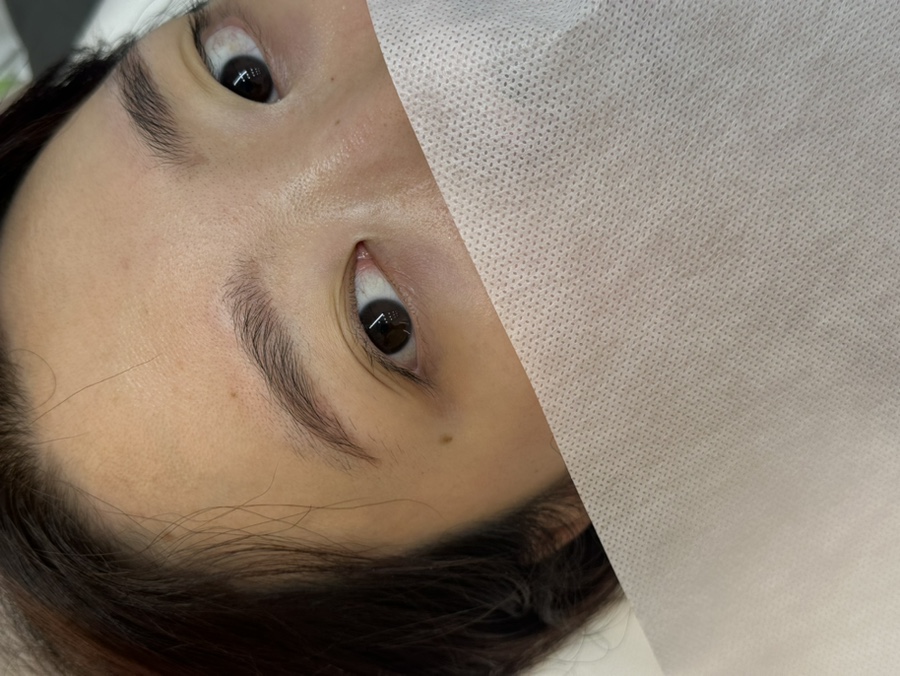 첨단위드 이미지