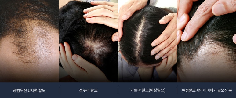 별헤어샵 이미지