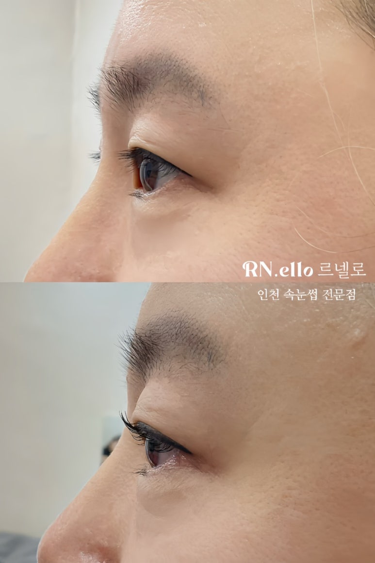 르넬로 이미지