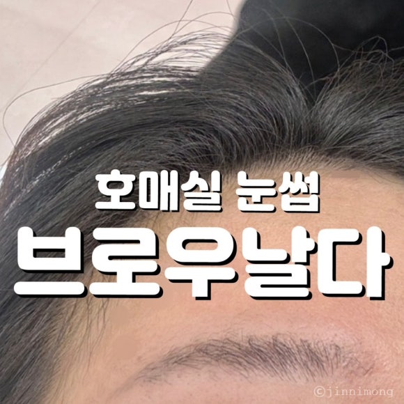 브로우날다 이미지