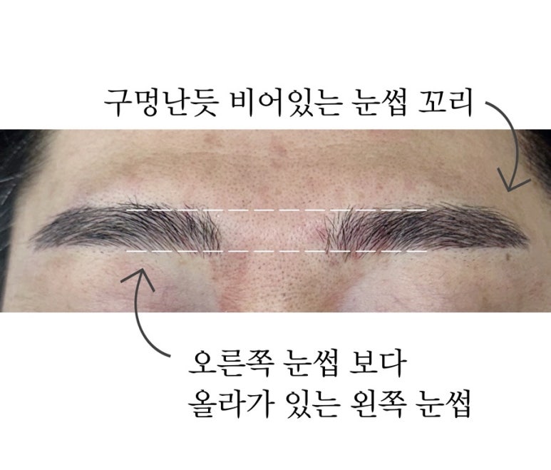 아티스트비에스 이미지