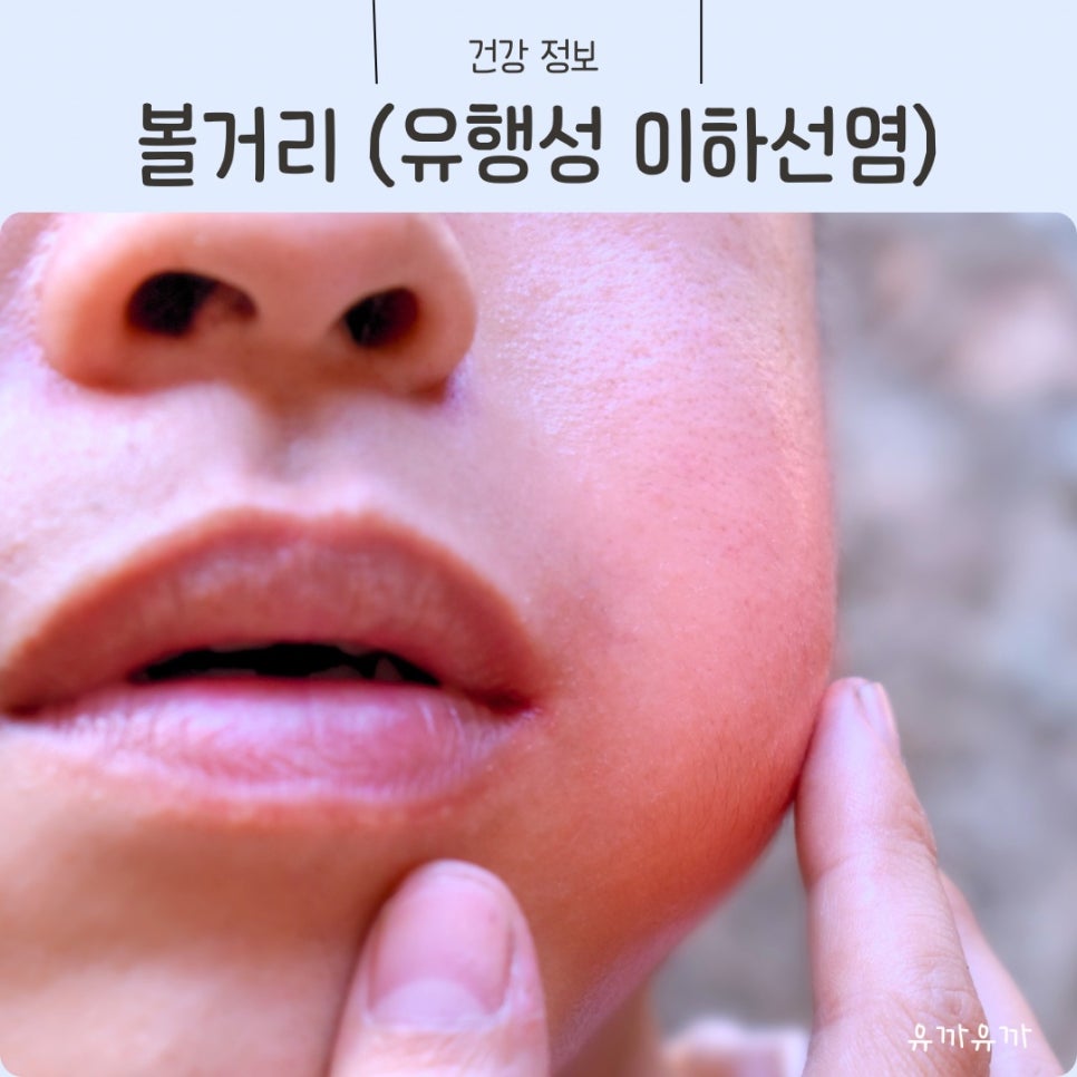 유아 볼거리 증상 전염 원인 병원 (유행성 이하선염) : 네이버 블로그