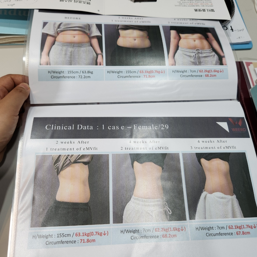 엠브이핏 이미지