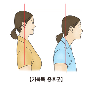 수퍼바디짐 이미지