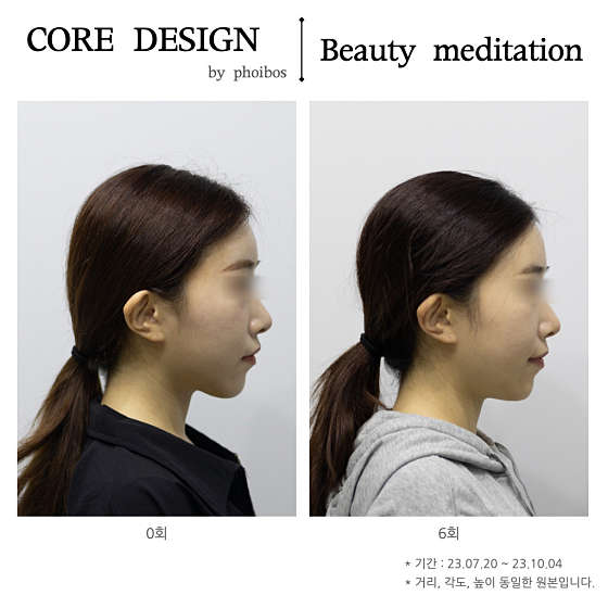 포이보스 이미지