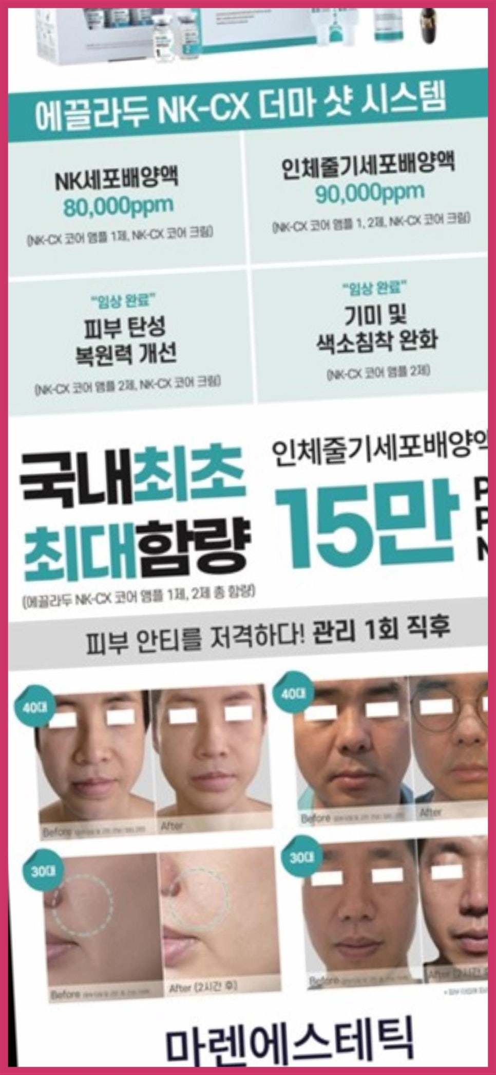 마렌에스테틱 이미지