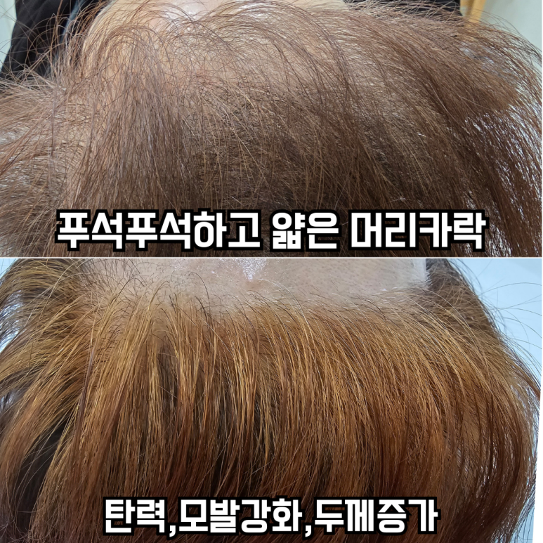 뷰티앤두피 이미지