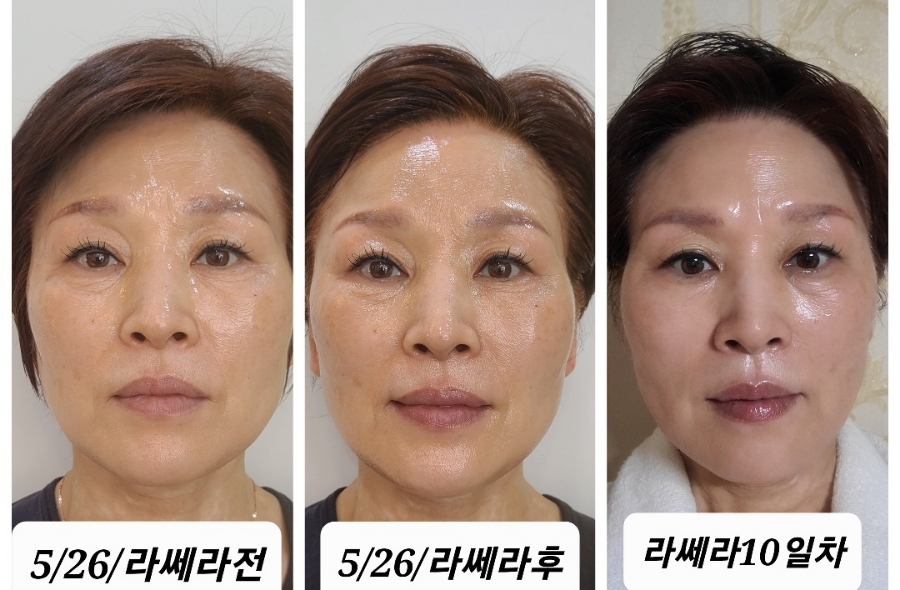 쏘자 이미지