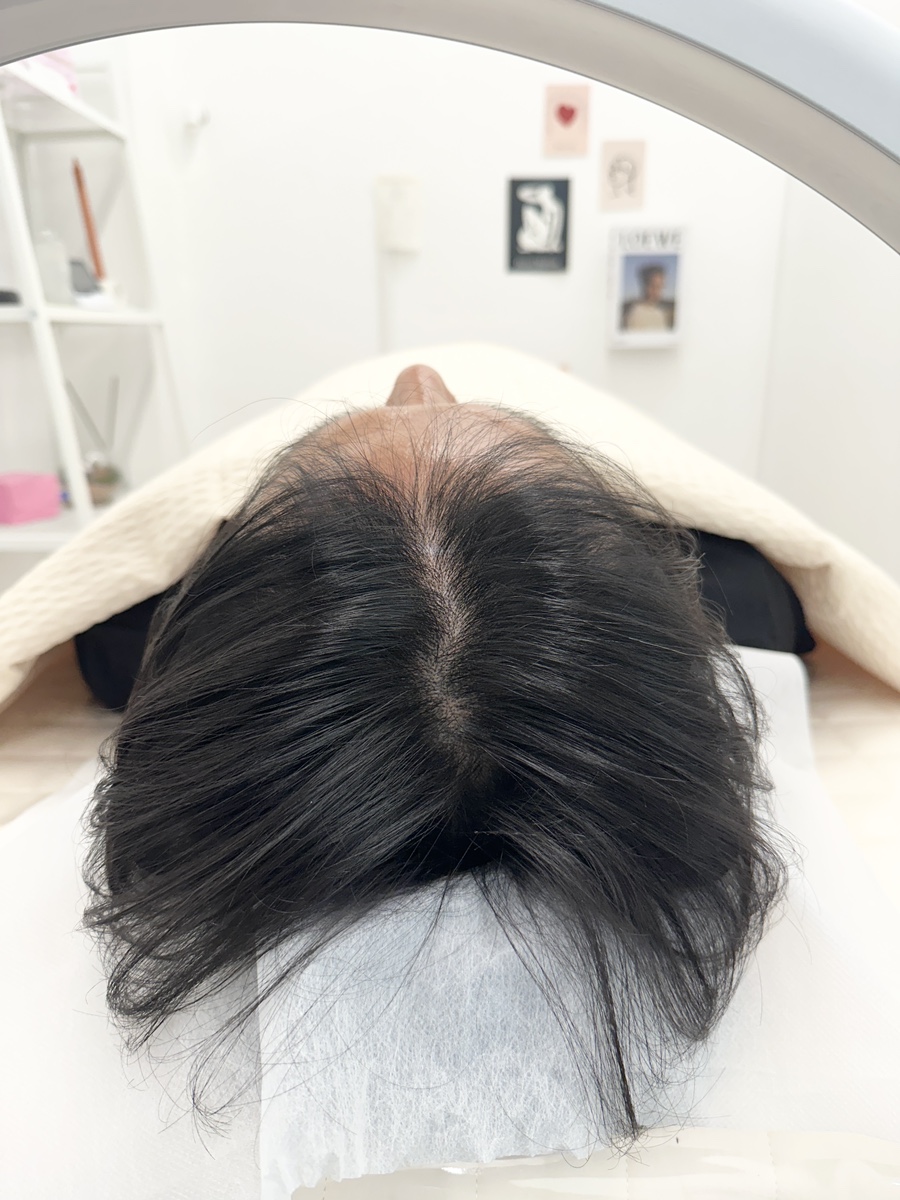블랙도트 이미지
