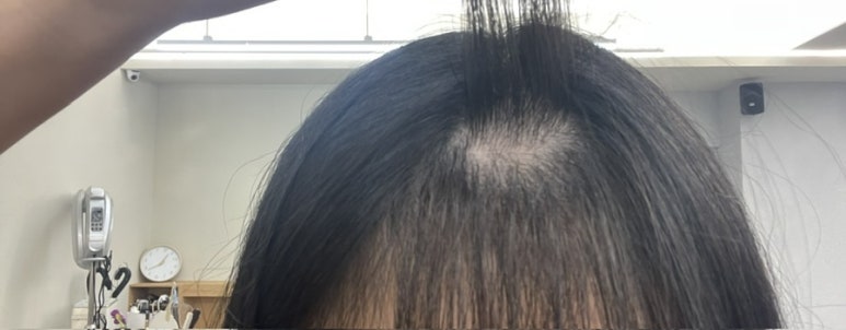 아토컷트 이미지