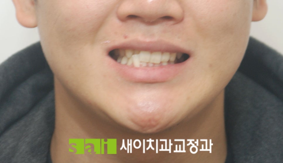 새이치과교정과치과의원 이미지