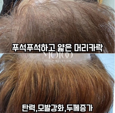 밀도뷰티 이미지