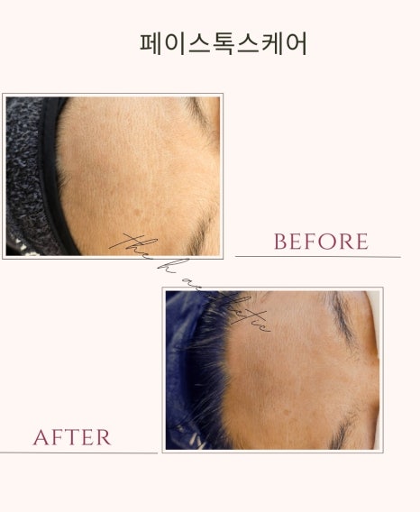 더케어에스테틱 이미지