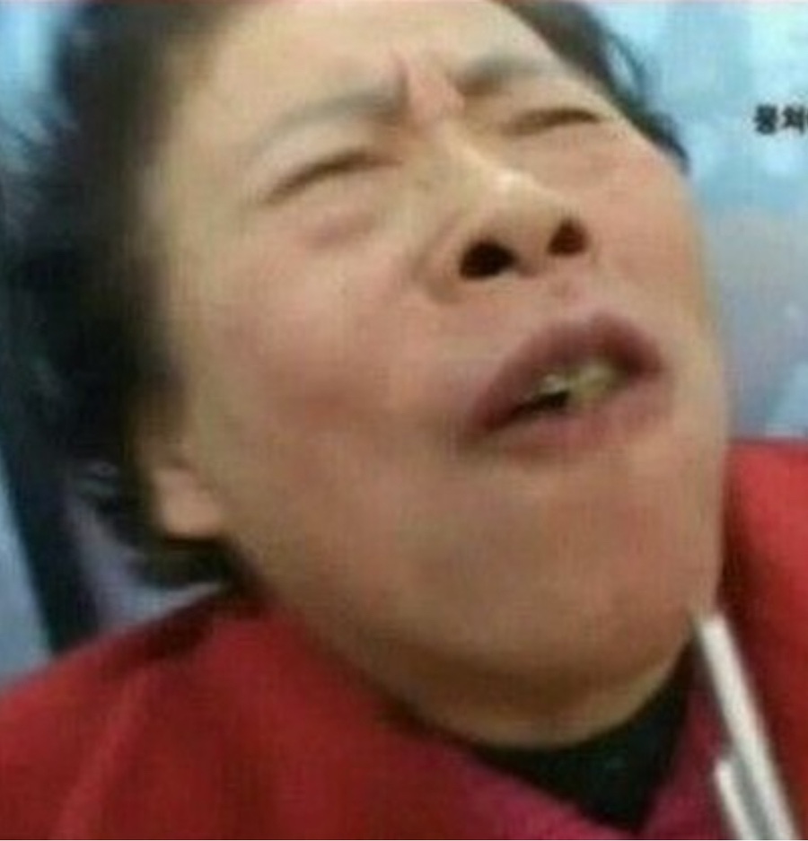 배스트보울 이미지