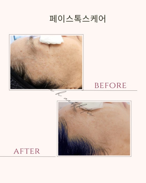 더케어에스테틱 이미지