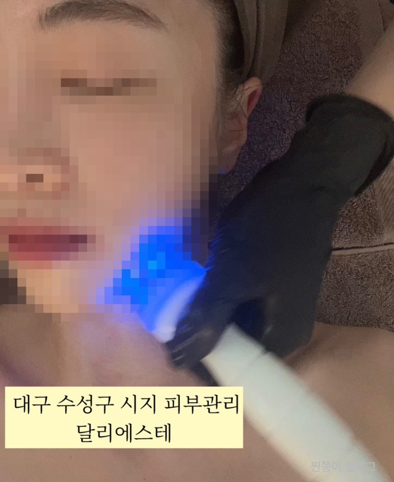 달리에스테 이미지
