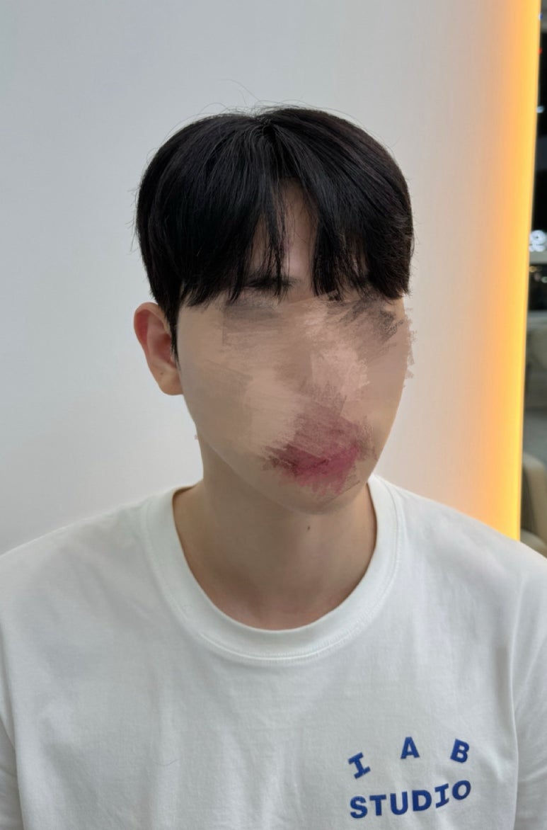 도레브헤어 이미지