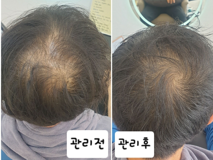 두피탈모태후사랑아주점 이미지