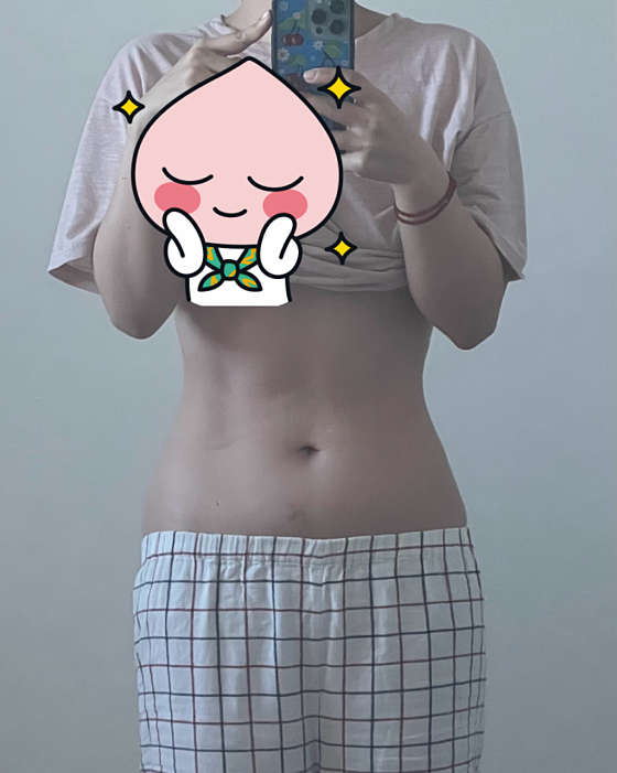 에이치피티 이미지