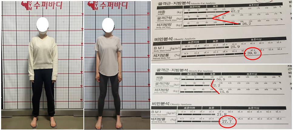 수퍼바디짐 이미지