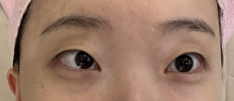 라멘떼에스테틱 이미지