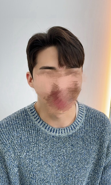 도레브헤어 이미지