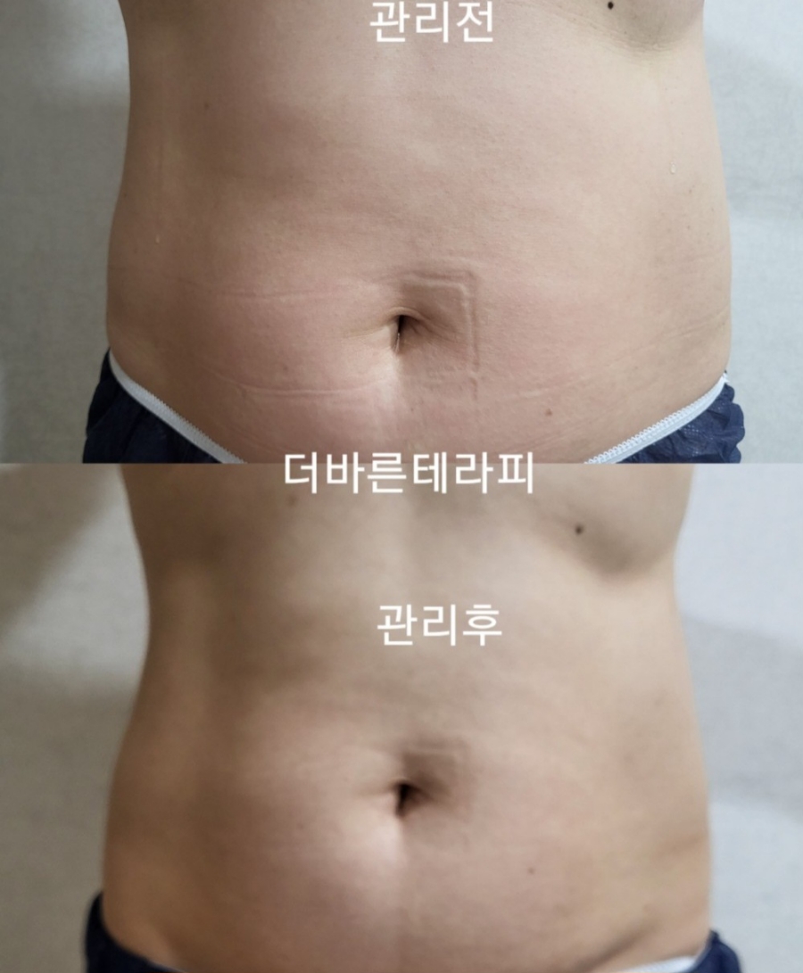 더바른테라피 이미지