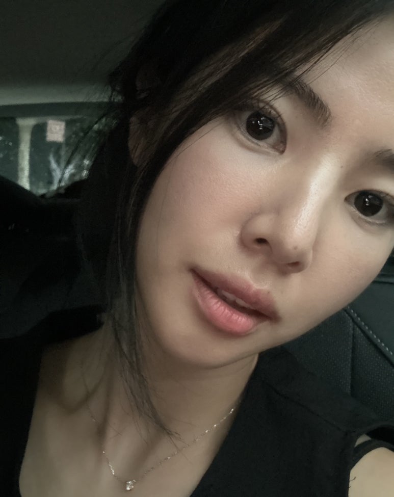 에스티크민 이미지