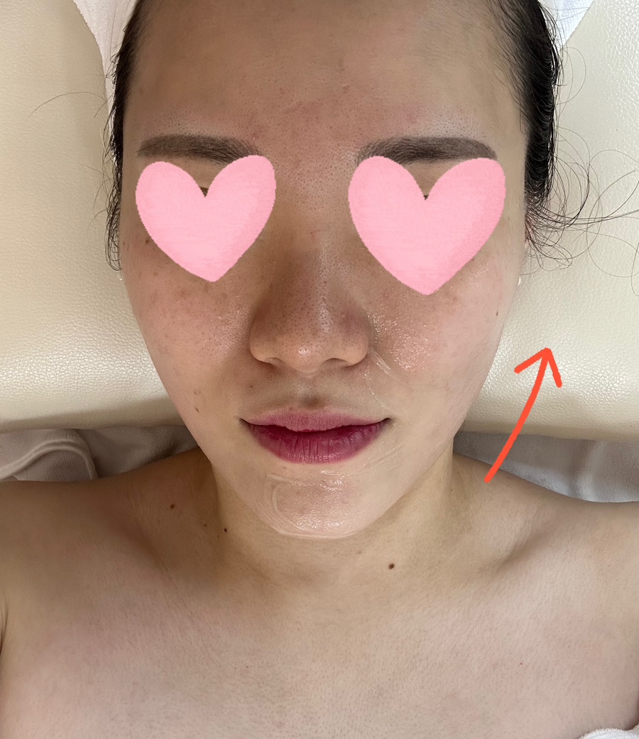 하영피부관리 이미지