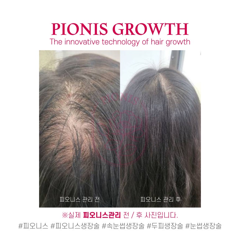 미모다뷰티 이미지