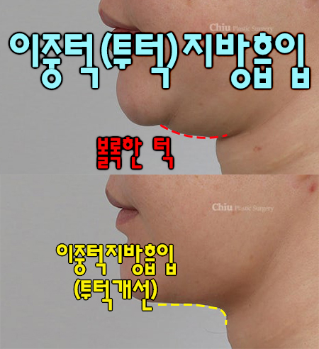 투턱 이미지
