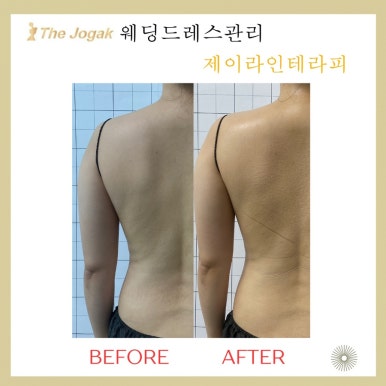 더조각테라피 이미지