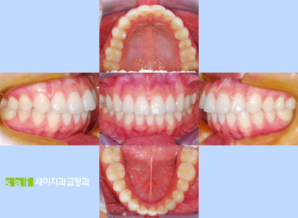 새이치과교정과치과의원 이미지