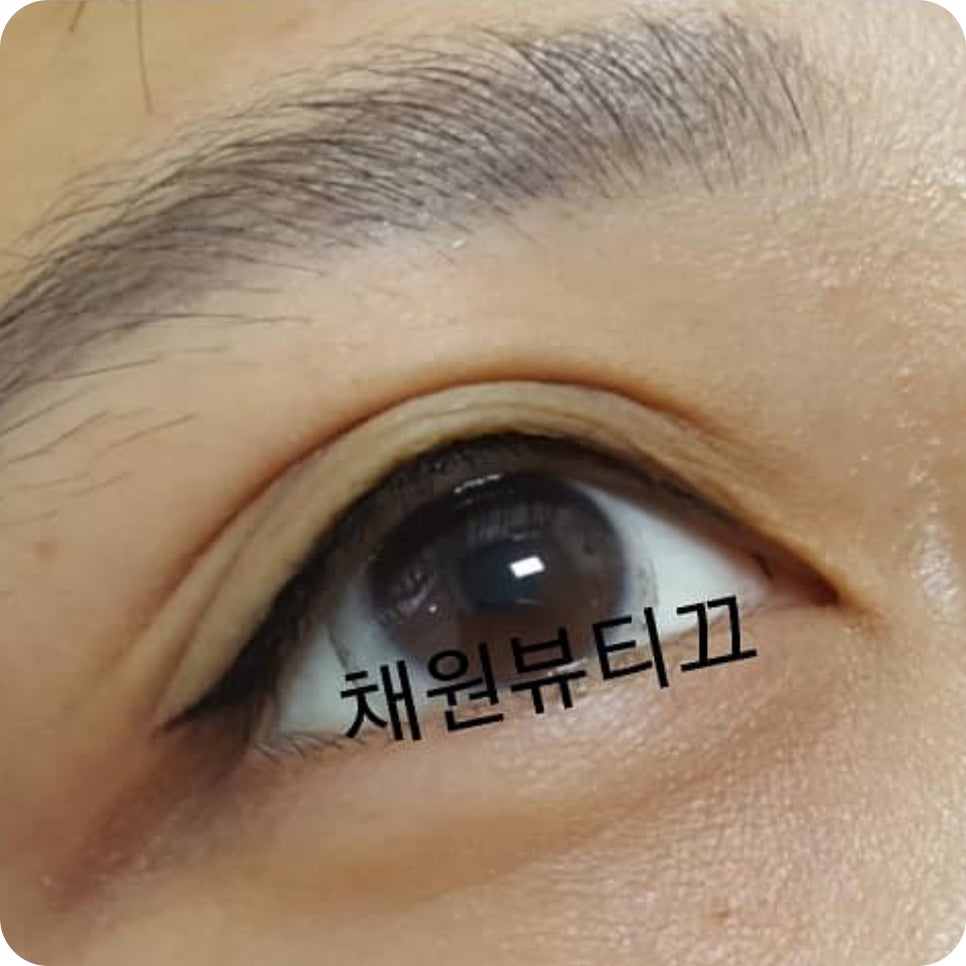채원스킨케어 이미지