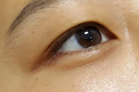 채원스킨케어 이미지